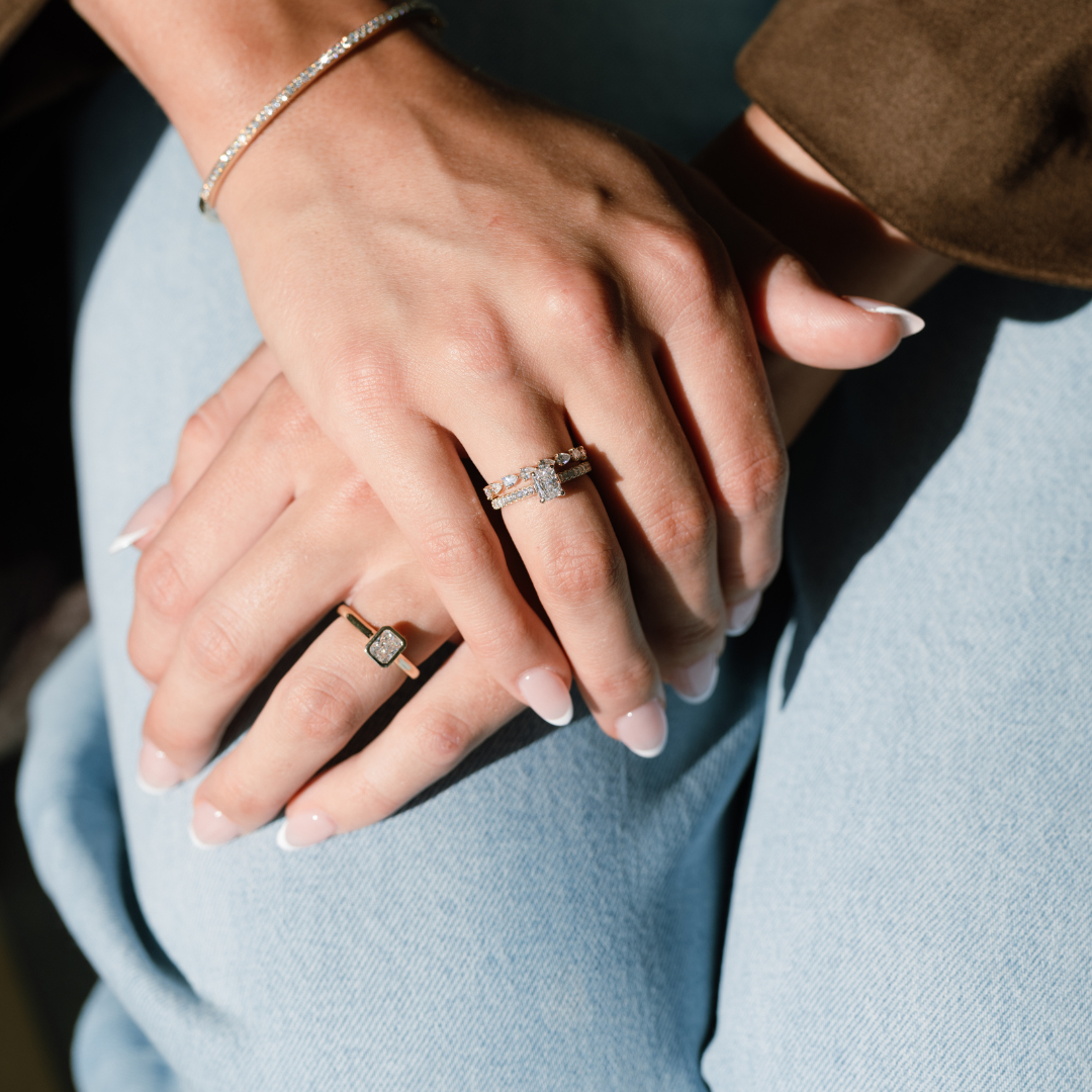 Two hands crossed together with rings and a bracelet